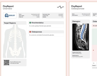 Foto: Floy | Wirbelsäule
