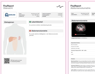 Foto: Floy | Abdomen