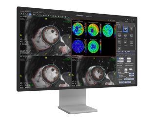 Foto: TeraRecon ⎮ AV