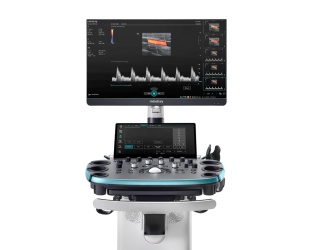 Foto: Mindray | Resona I8