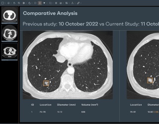 Foto: Rayscape Lung CT
