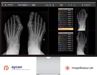 aycan (Unternehmen der PARATUS Gruppe) und ImageBiopsy Lab bringen KI-Bildanalyse in den klinischen Workflow