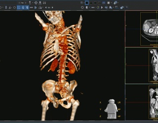 Foto: Dedalus HealthCare | DeepUnity Diagnost & DICOM Services...