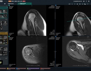 Foto: Dedalus HealthCare | DeepUnity PACSonWEB