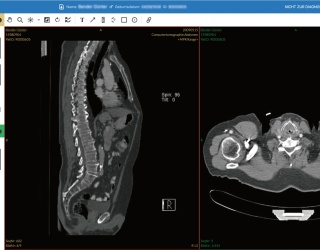 Foto: Dedalus HealthCare | DeepUnity Viewer