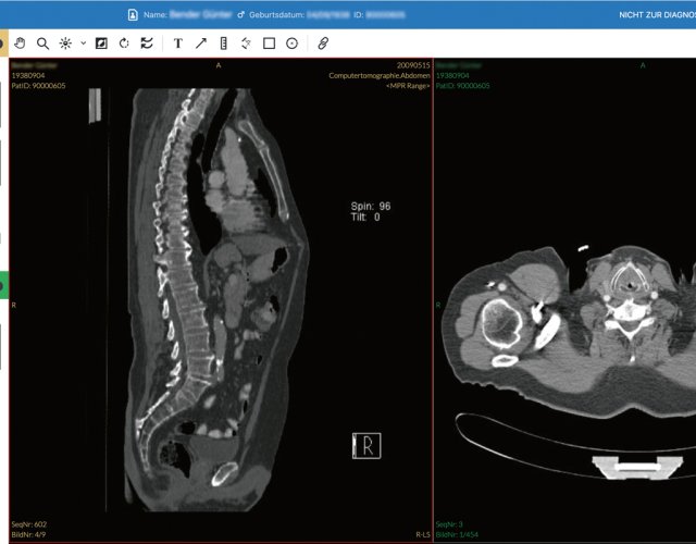 DeepUnity PACSonWEB - RadMag - Online-Journal für die Radiologie ...
