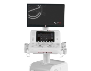 Foto: Esaote | MyLabX75
