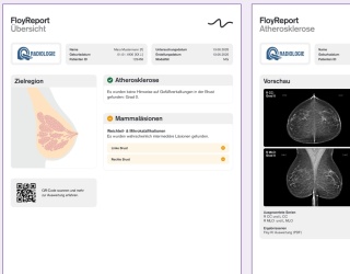 Foto: Floy | Mammografie