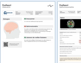 Foto: Floy | Gehirn