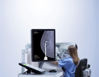 Foto: HOLOGIC | Affirm Contrast Biopsy Software...