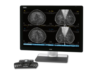 Foto: HOLOGIC | 3DQuorum Technologie