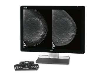 Foto: HOLOGIC | Intelligent 2D Bildgebungstechnologie...