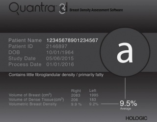 Foto: HOLOGIC | Quantra