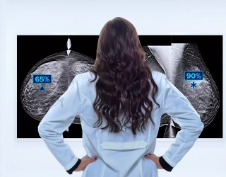 Foto: HOLOGIC | Genius AI Detection