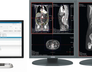 Foto: Nexus Enterprise Imaging | RVC RIS