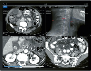 Foto: Nexus Enterprise Imaging | RVC mobile
