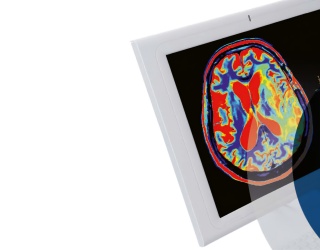 Foto: RSNA Update