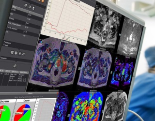 Foto: Canon Medical | Vitrea Advanced Visualization...
