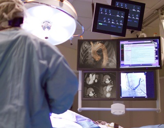 Foto: Canon Medical | Vitrea Enterprise