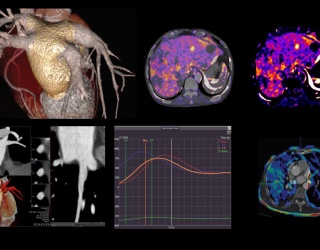 Foto: Canon Medical | Vitrea Extend