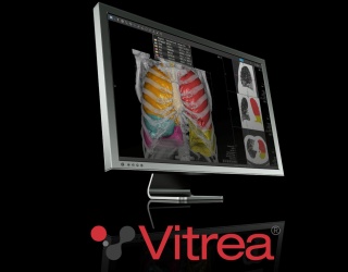 Foto: Canon Medical | Vitrea Workstation