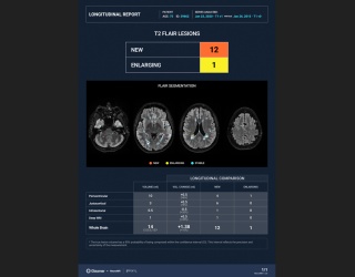 Foto: Gleamer | MRNeuroMS