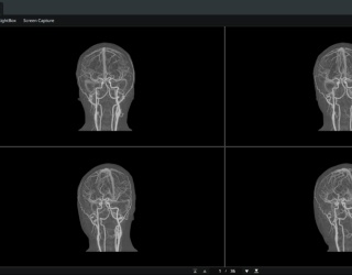 Foto: Coreline | aview BAS