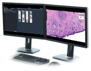 Foto: Fujifilm | Synapse Pathology