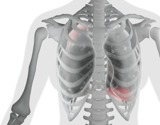 Foto: Injecto Med | AZmed · AZchest