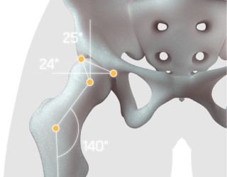 Foto: Injecto Med | AZmed · AZmeasure