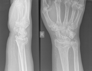 Foto: Injecto Med | AZmed · Rayvolve Trauma