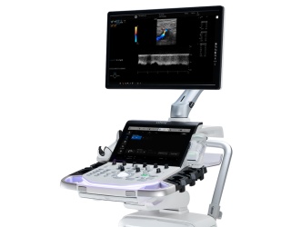 Foto: GE HealthCare| LOGIQ Totus