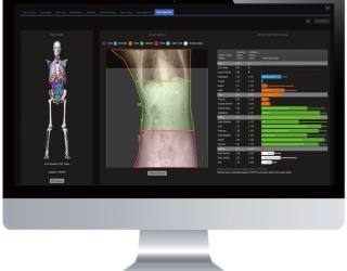 Foto: GE HealthCare | Dosewatch