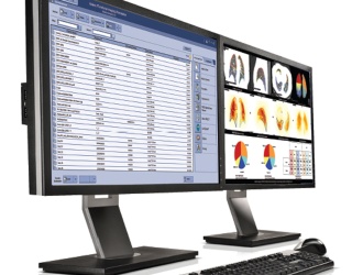 Foto: GE HealthCare | Xeleris V & Xeleris 4DR