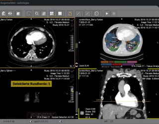 Foto: Visus Health |  JiveX Enterprise PACS