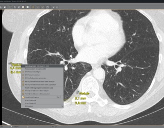 Foto: Visus Health |  JiveX KI-Workflow