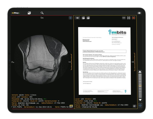 Dedalus HealthCare | DeepUnity Vie - RadMag - Online-Journal für die ...