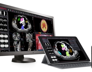 Foto: medDream |  Enterprise DICOM Viewer