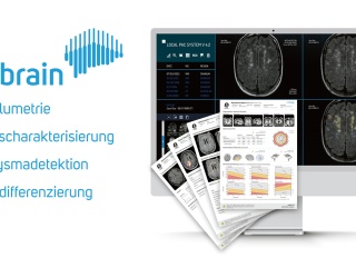 Foto: mediaire | mdbrain
