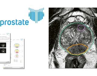 Foto: mediaire | mdprostate