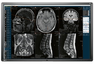 Foto: medigration | ImageVision