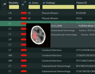 Foto: Fujifilm | Synapse AI Orchestrator