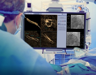 Foto: GE HealthCare | 3DStent