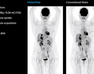 Foto: GE HealthCare | MotionFree