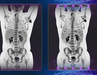 Foto: GE HealthCare | Precision DL