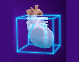 Foto: GE HealthCare | SnapShot Freeze 2