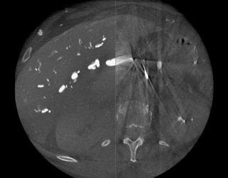 Foto: GE HealthCare | ClearRecon DL*