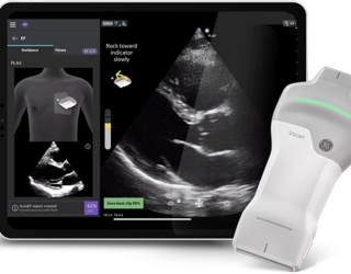 Foto: GE HealthCare | Caption AI