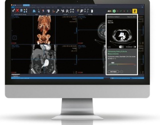 Foto: Philips | Imaging Analytics