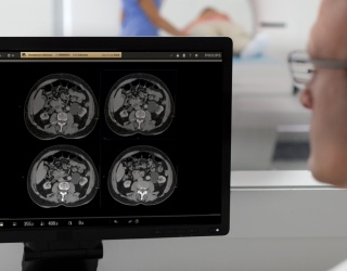 Foto: Philips | Precise Image